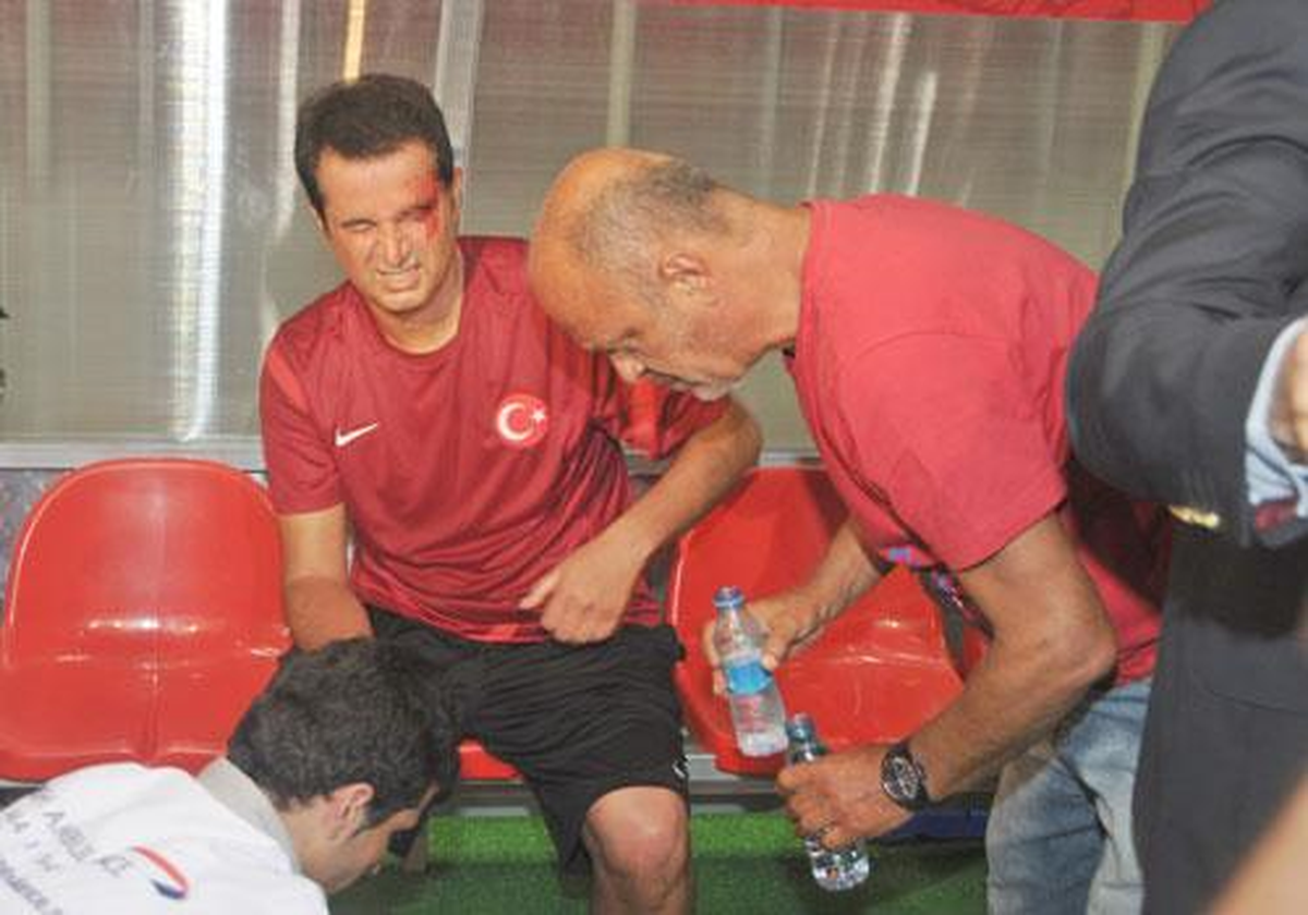 Acun\'un Kaşı Yarıldı