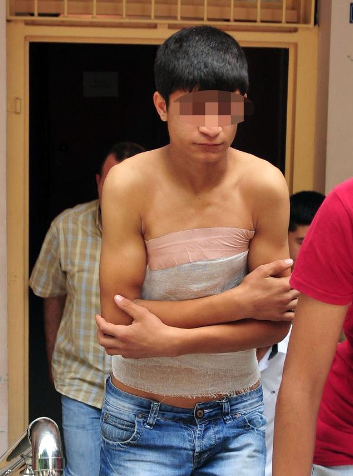 Polise Atmak İstediği Molotof Kokteyli ile Kendini Yaktı