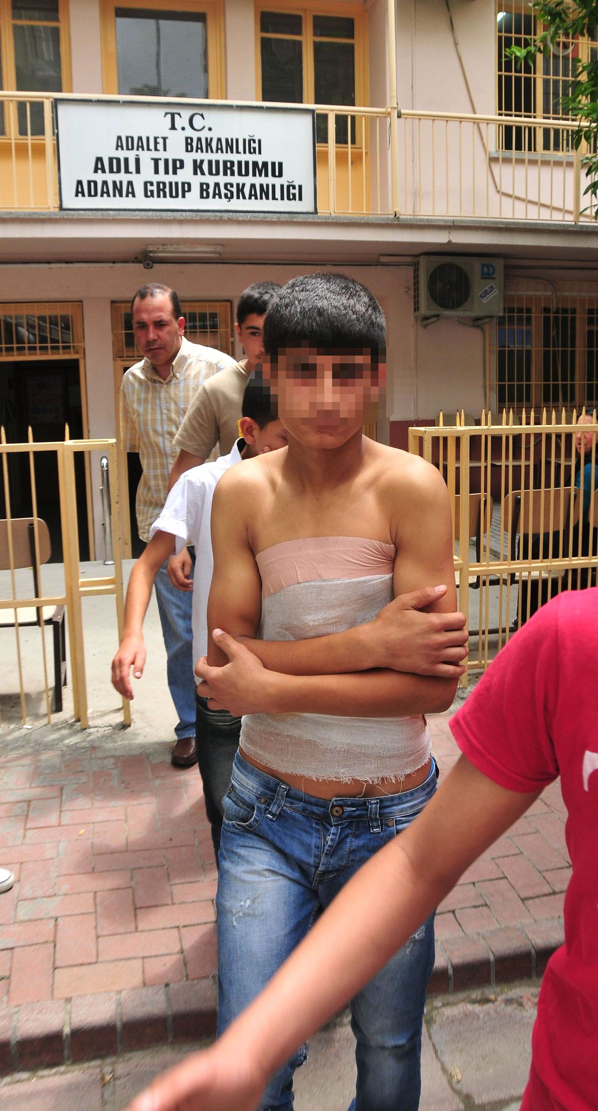 Polise Molotof Atarken Kendini Yaktı