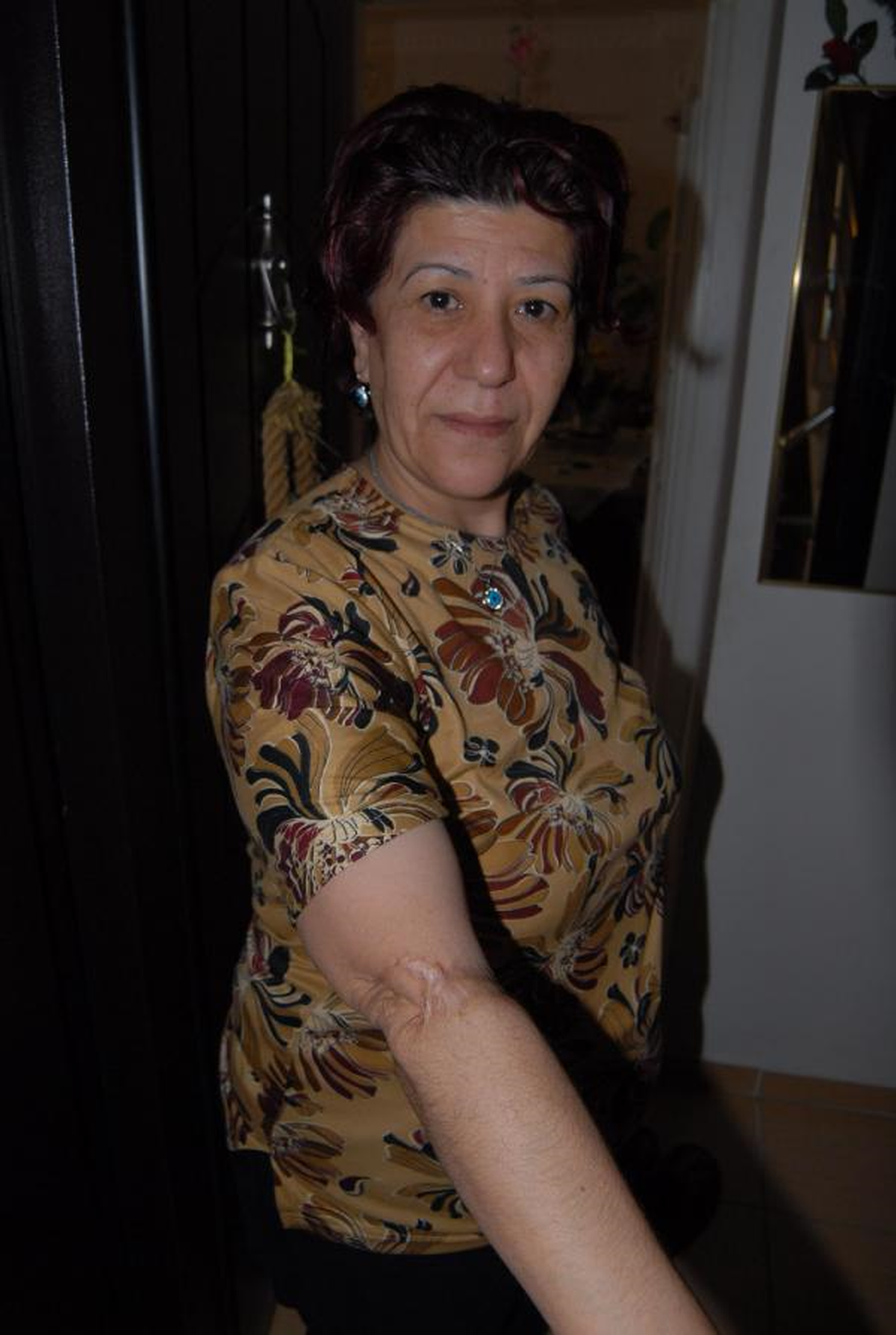 \'Keş\' Isırdı, Sahibi Ceza Aldı