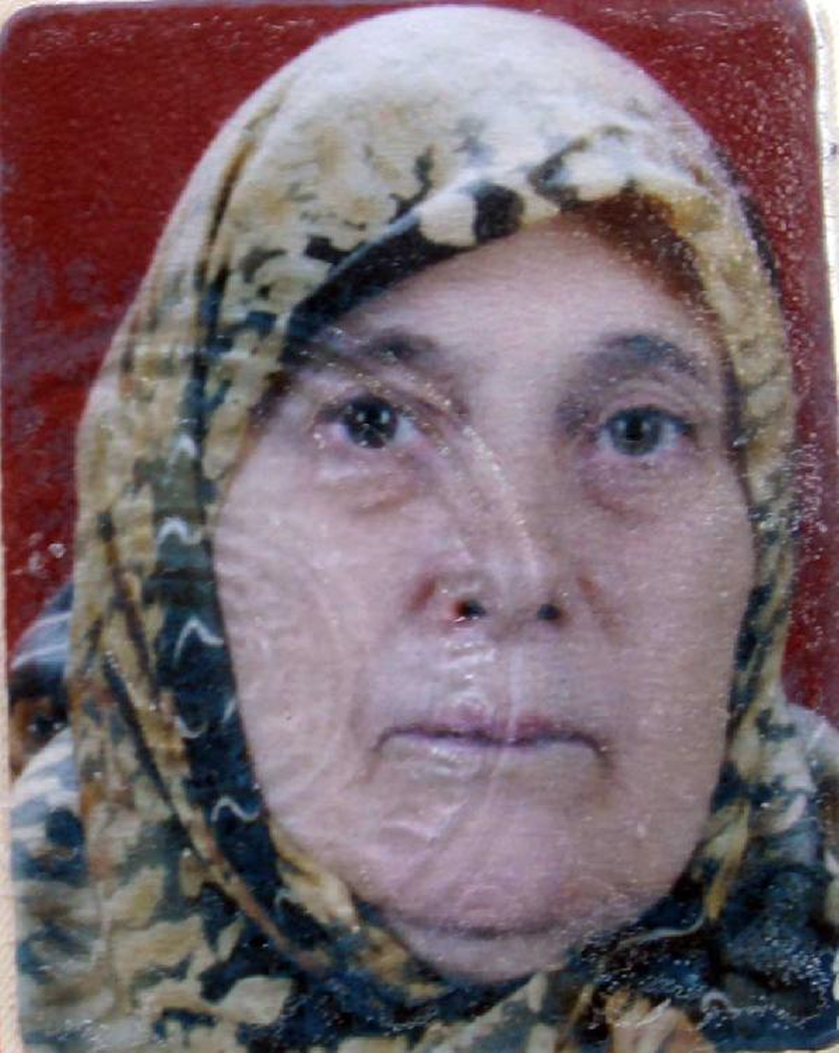 Merdivenlerden Düşen Kadın Öldü