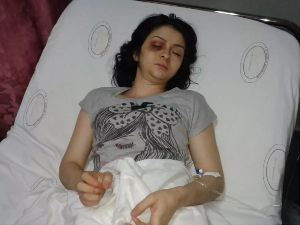 Şiddet Nedeniyle Boşandığı Eşine Çocuğu İçin Geri Döndü, Bu Kez de Kızgın Yağ ile Haşlandı