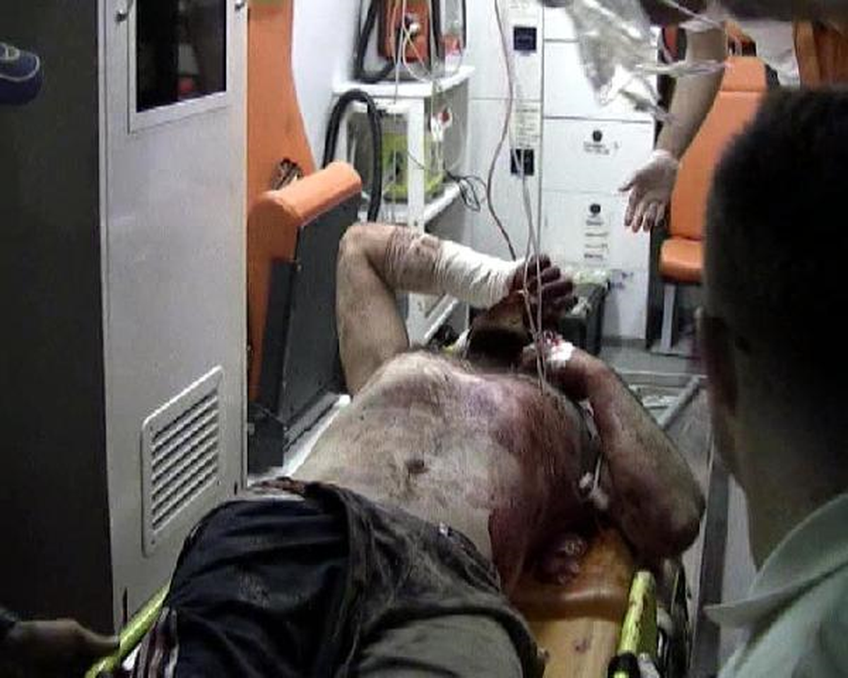 Yaralı 17 Suriyeli, Hatay'a Getirildi