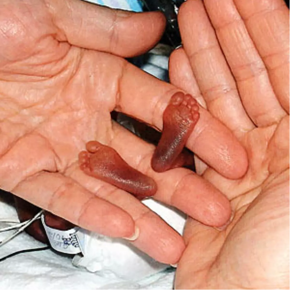 Kürtaj Hangi Ülkelerde Yasak?