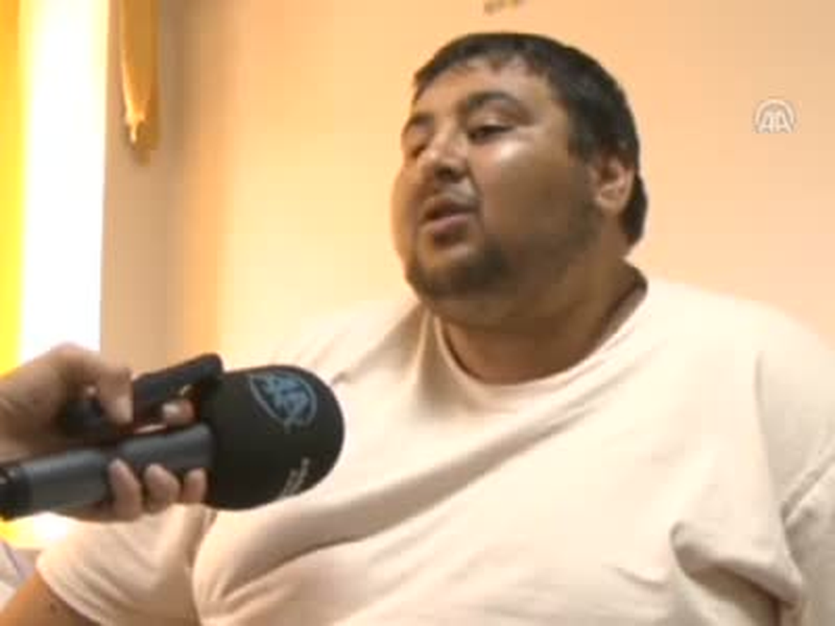 Bu Hastalık Dünyada Sadece 2 Kişide Var