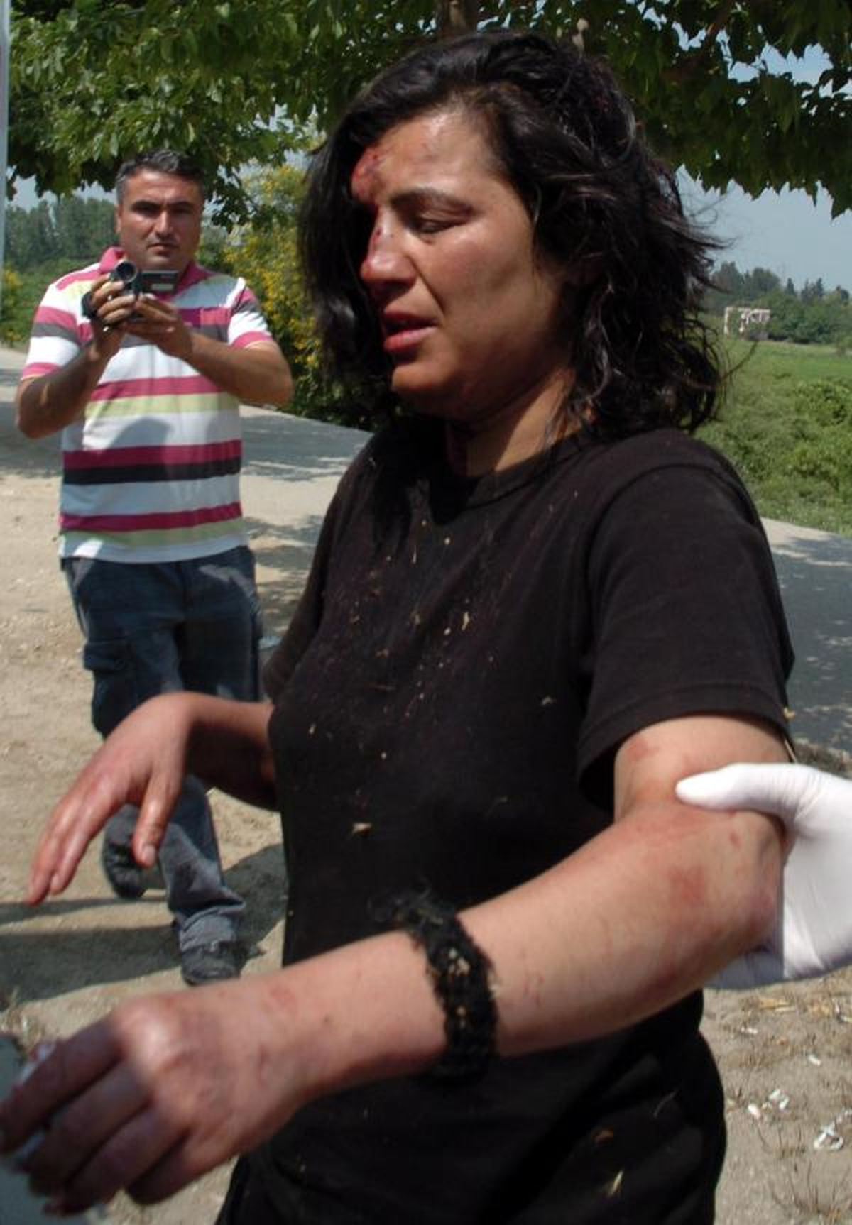 Yolda Kanlar İçinde Bulundu, Nikahsız Eşinin Otomobilden Attığını Söyleyip Bayıldı