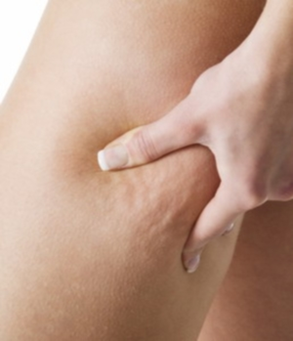 Selülitin Çözümü Sizde Saklı