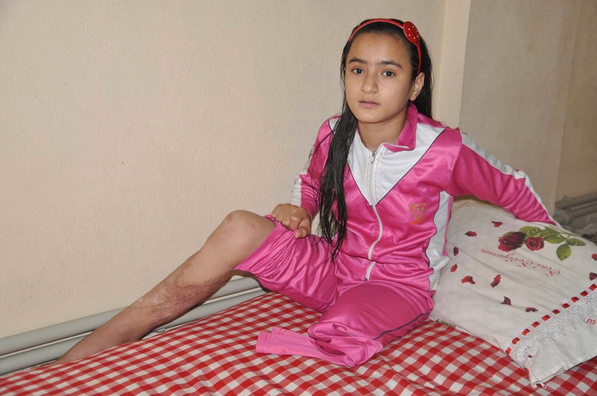 Bacağı Olmayan Kızın Özürlü Raporu Düzeltildi