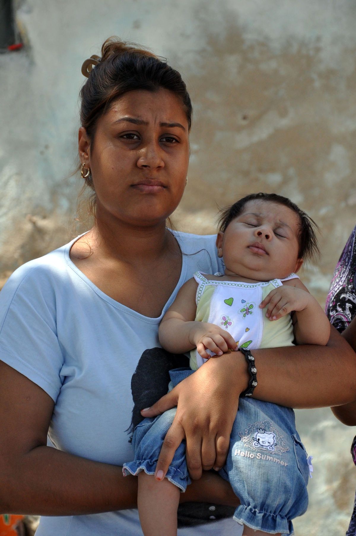 Belkıs Bebek 60 Bin TL Bulunamazsa Kör Kalacak