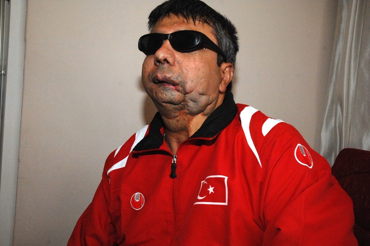 Görme Engelli Gaziye Davet
