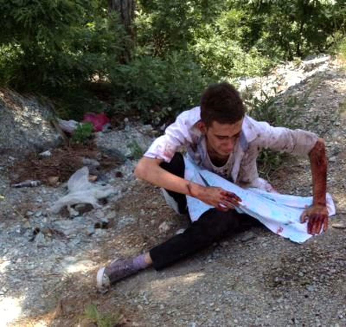 Pikniğe Gittikleri Yaylada Mayına Basan 2 Arkadaş Yaralandı