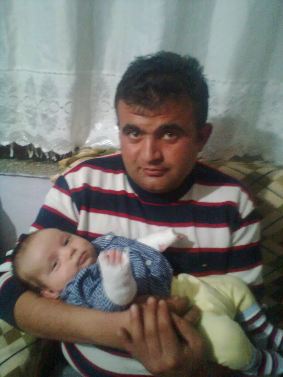 Tar Sendromuna Yakalanan Altı Aylık Bebeğin Çilesi