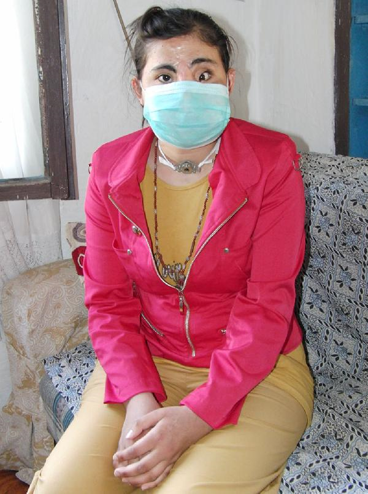 Yüz Nakli Yapılan Hatice İş İstiyor