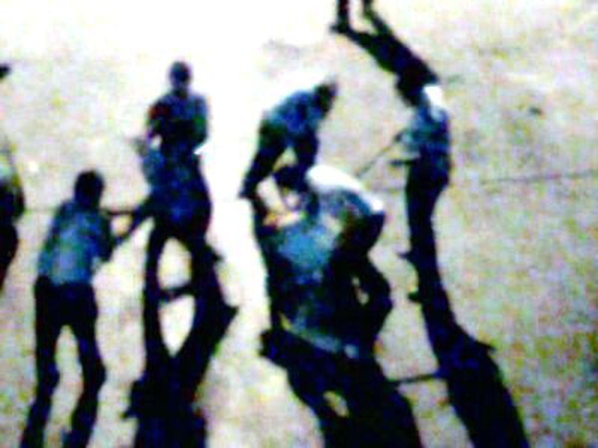 Polislerin Dövdüğü Adam Konuştu