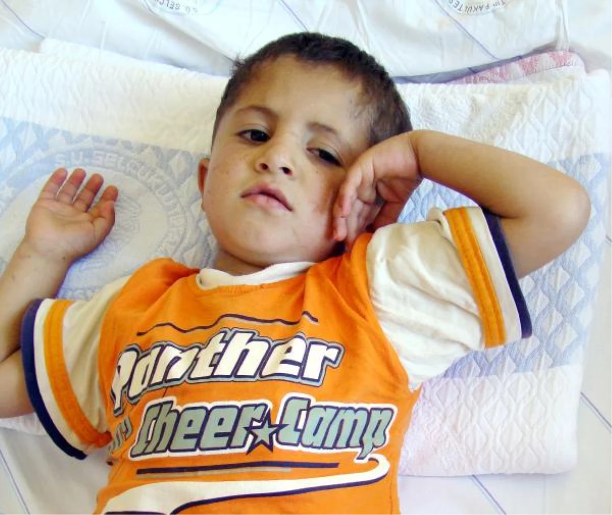 Doğuştan Kalbi Delik Olan 4,5 Yaşındaki Mehmet, Artık Koşabilecek