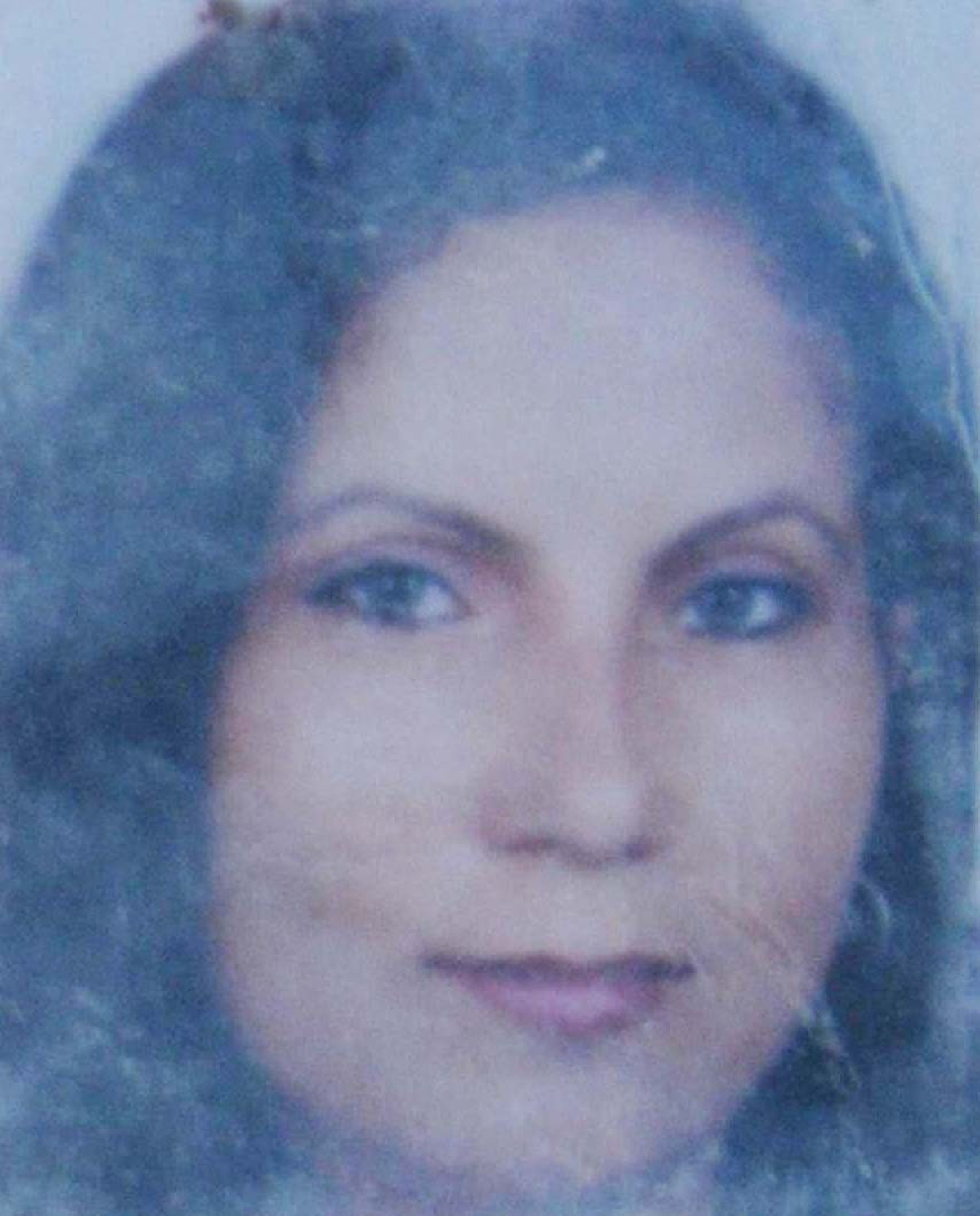 Sevgilisini 8 Yerinden Bıçakladı
