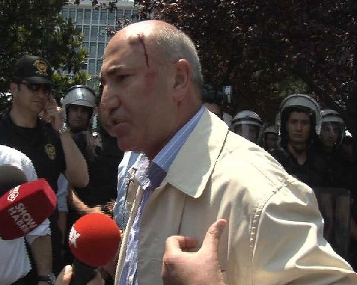 CHP Milletvekili Tanal "Kentsel Dönüşüm" Eyleminde Başından Yaralandı