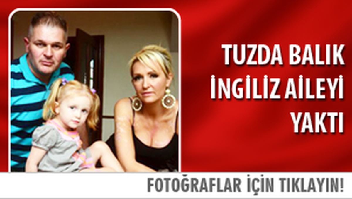 Tuzda Balık İngiliz Aileyi Yaktı