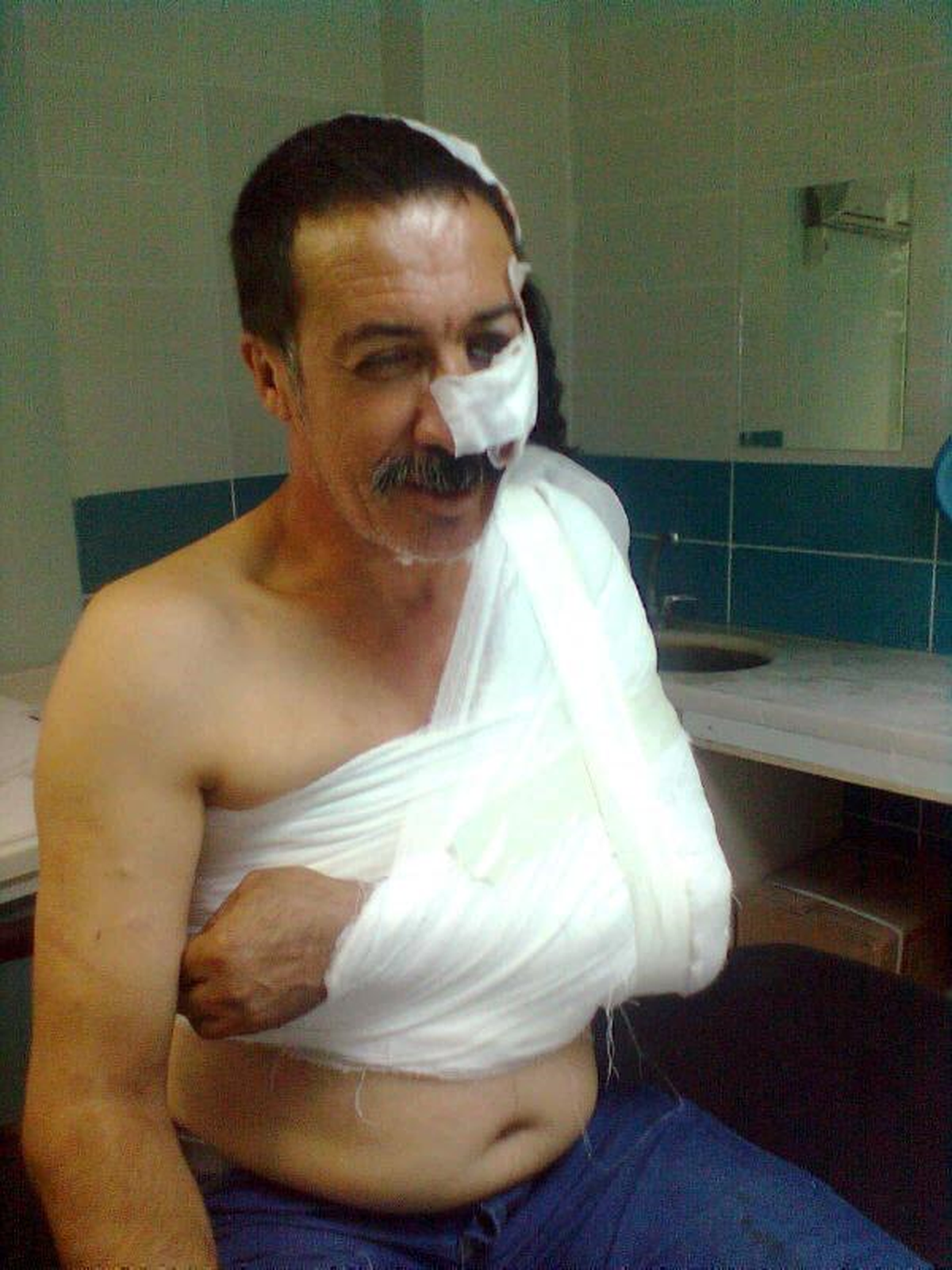 Görme Özürlüleri Kalkındırma Derneği\'ne Sopalı Saldırı: 1 Yaralı