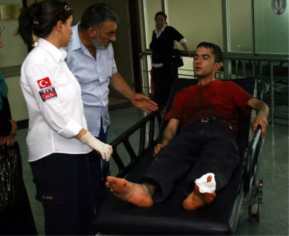 Ayağını Makineye Sıkıştırdı