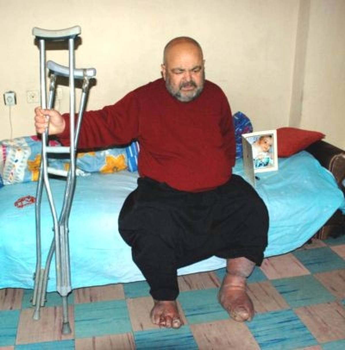 Fil Hastası Hayatını Kaybetti