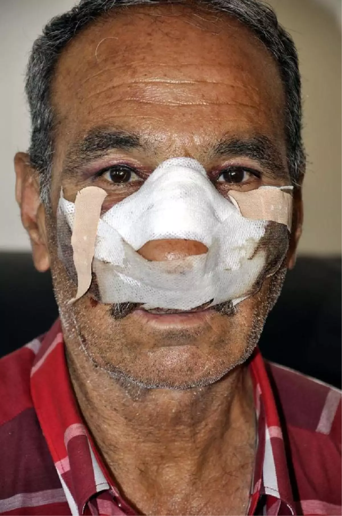 Zabıtaya \'Burun Kırma\' Suçlaması