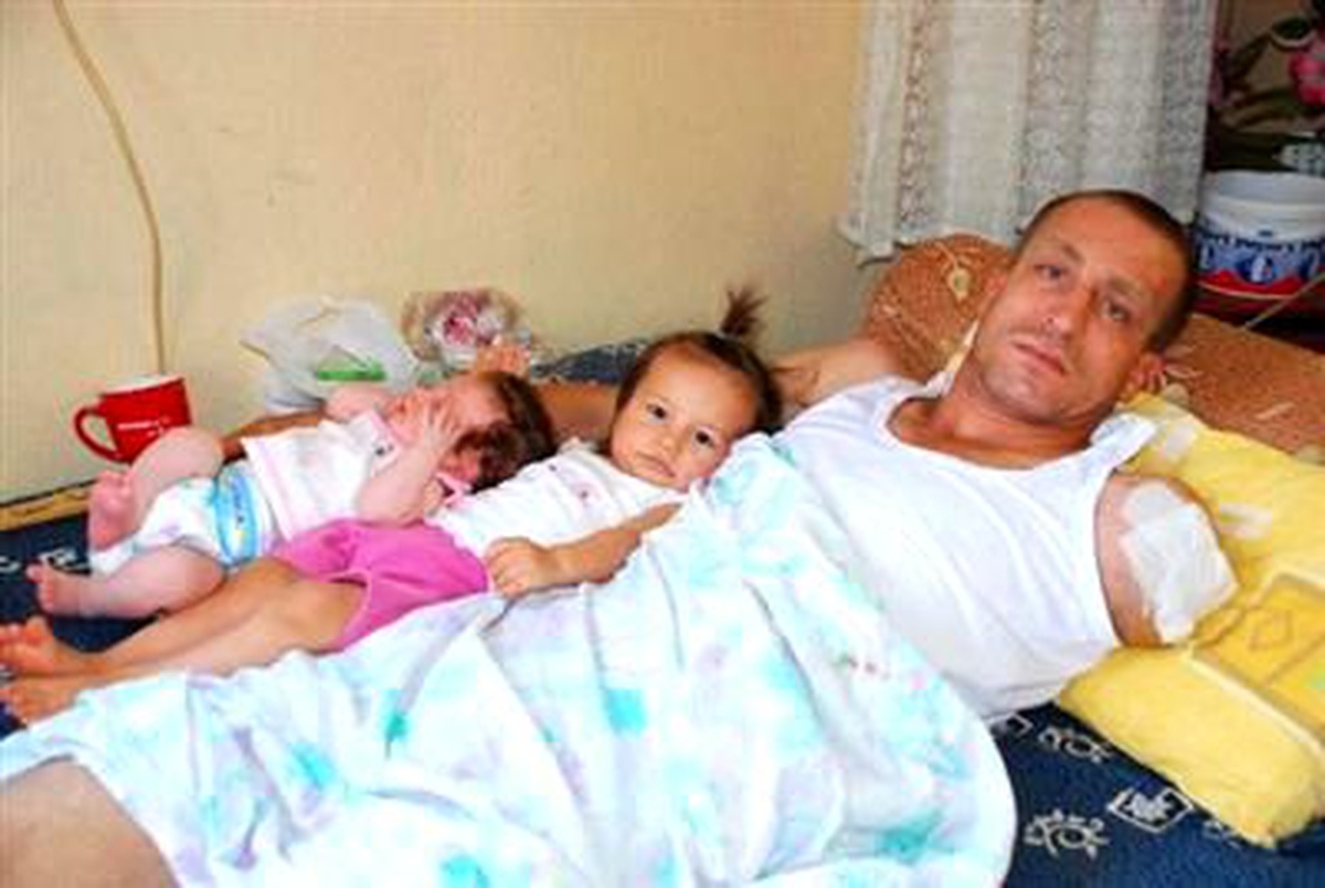 Kaza Sonrası Kolu Kopan Şahıs Dava Hazırlığında