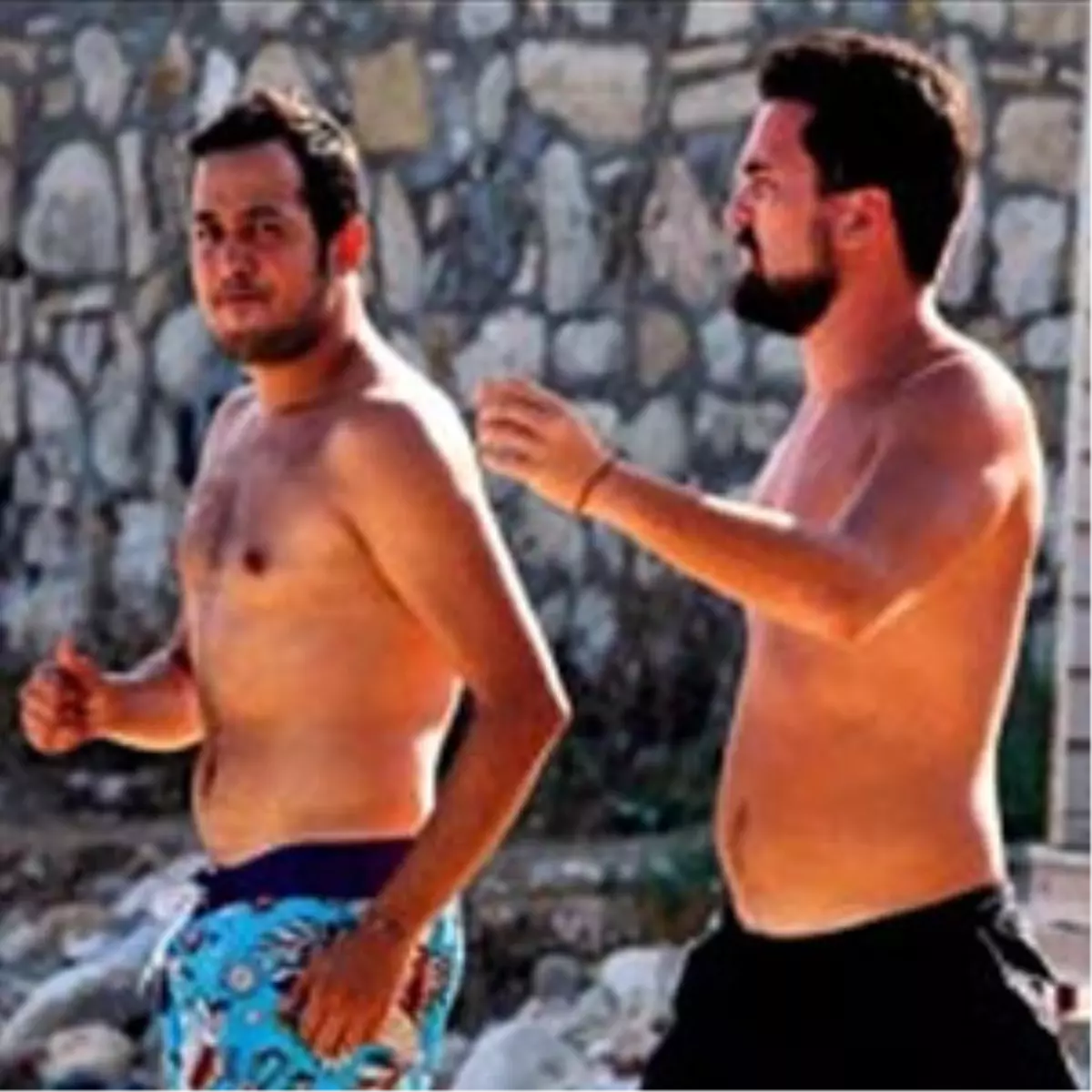 Karnını Çekme Operasyonu