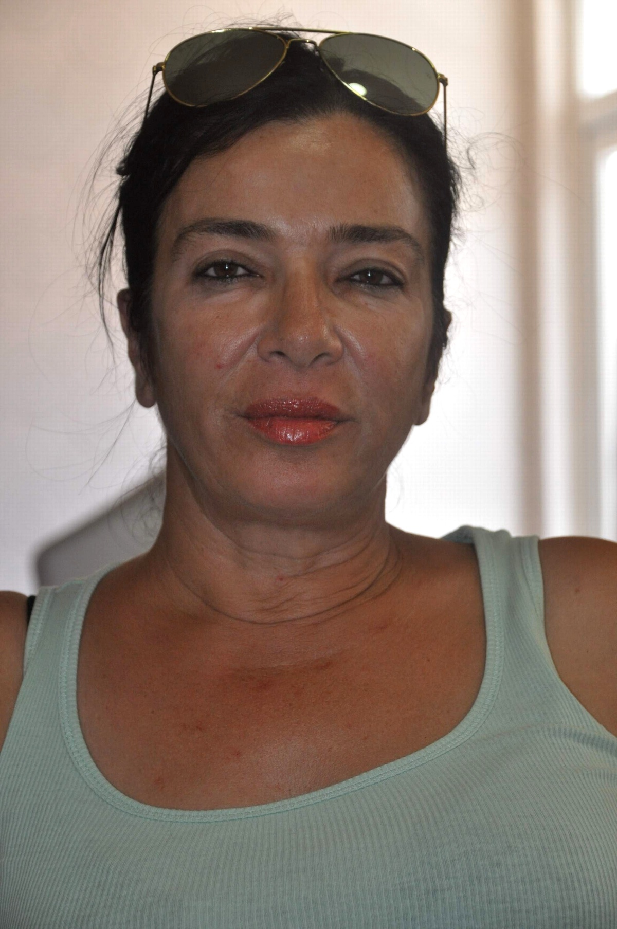 Turistler Yakılmak Değil Kefenlenmek İstiyor
