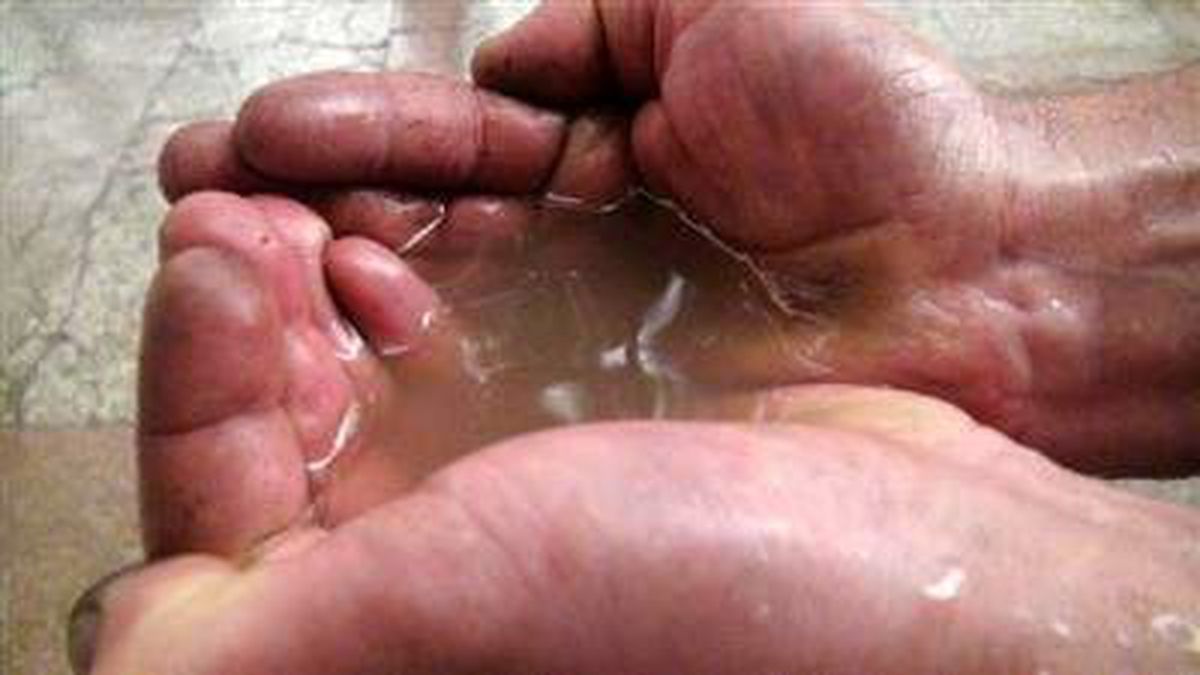 Kars\'a Çamur Yağdı