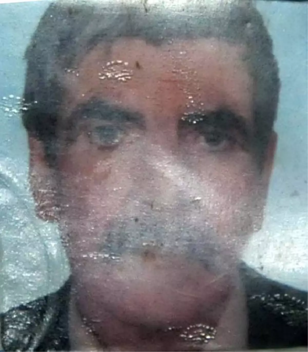 Dövülen Hurdacı Hastanede Öldü