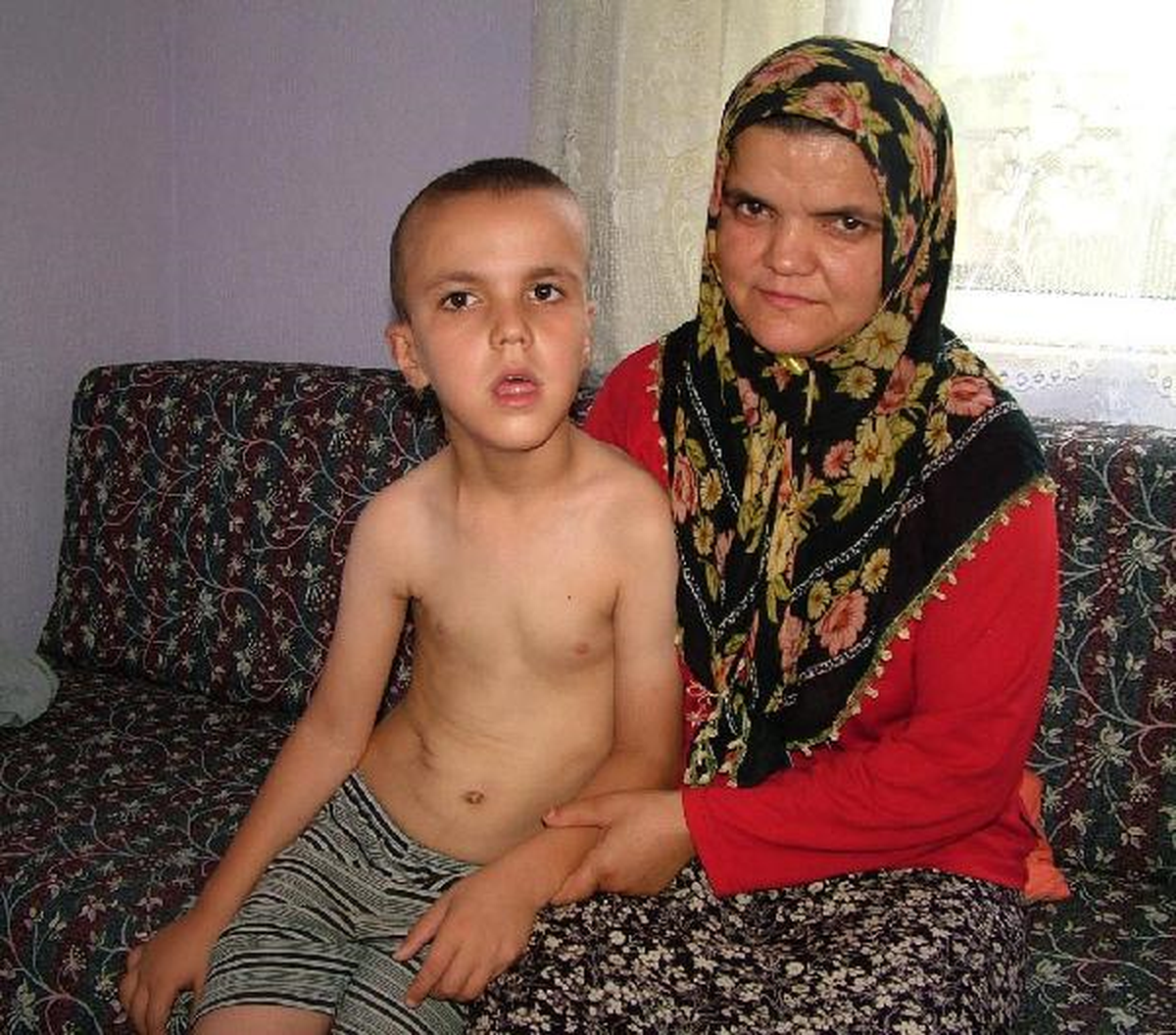 7 Yaşında, 14 Ameliyat Geçirdi