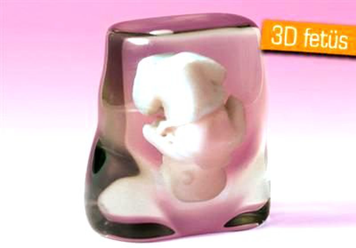 Doğmamış Bebeğinizin 3d Modeli 1250 Dolar