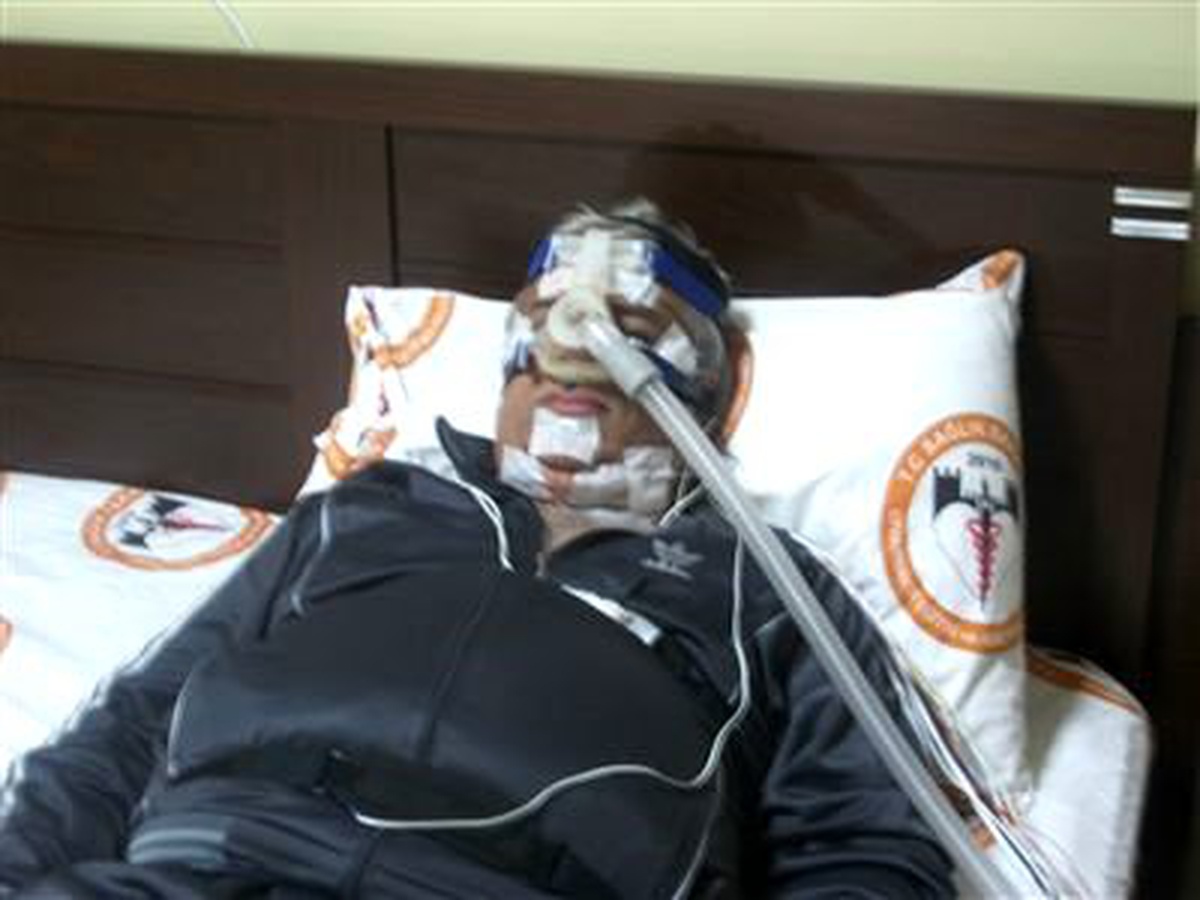 Horlama Uyku Bozukluğuna Neden Oluyor