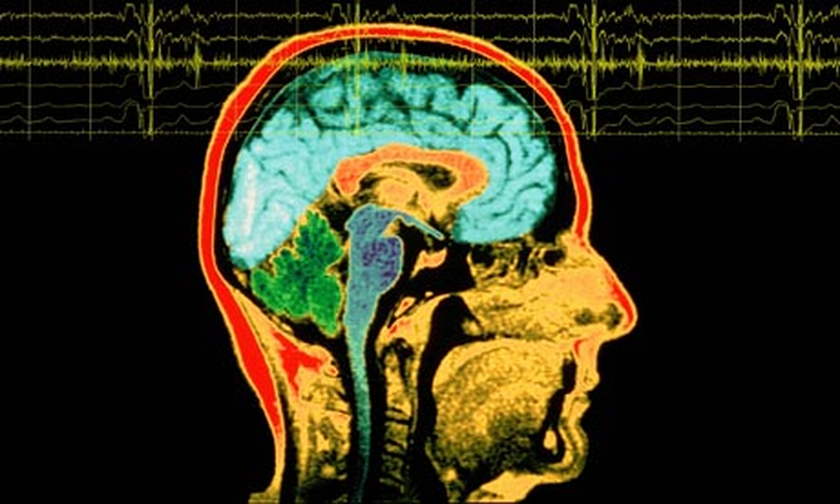 Beyinde Yeni Bir 'Kanalizasyon' Sistemi Keşfedildi