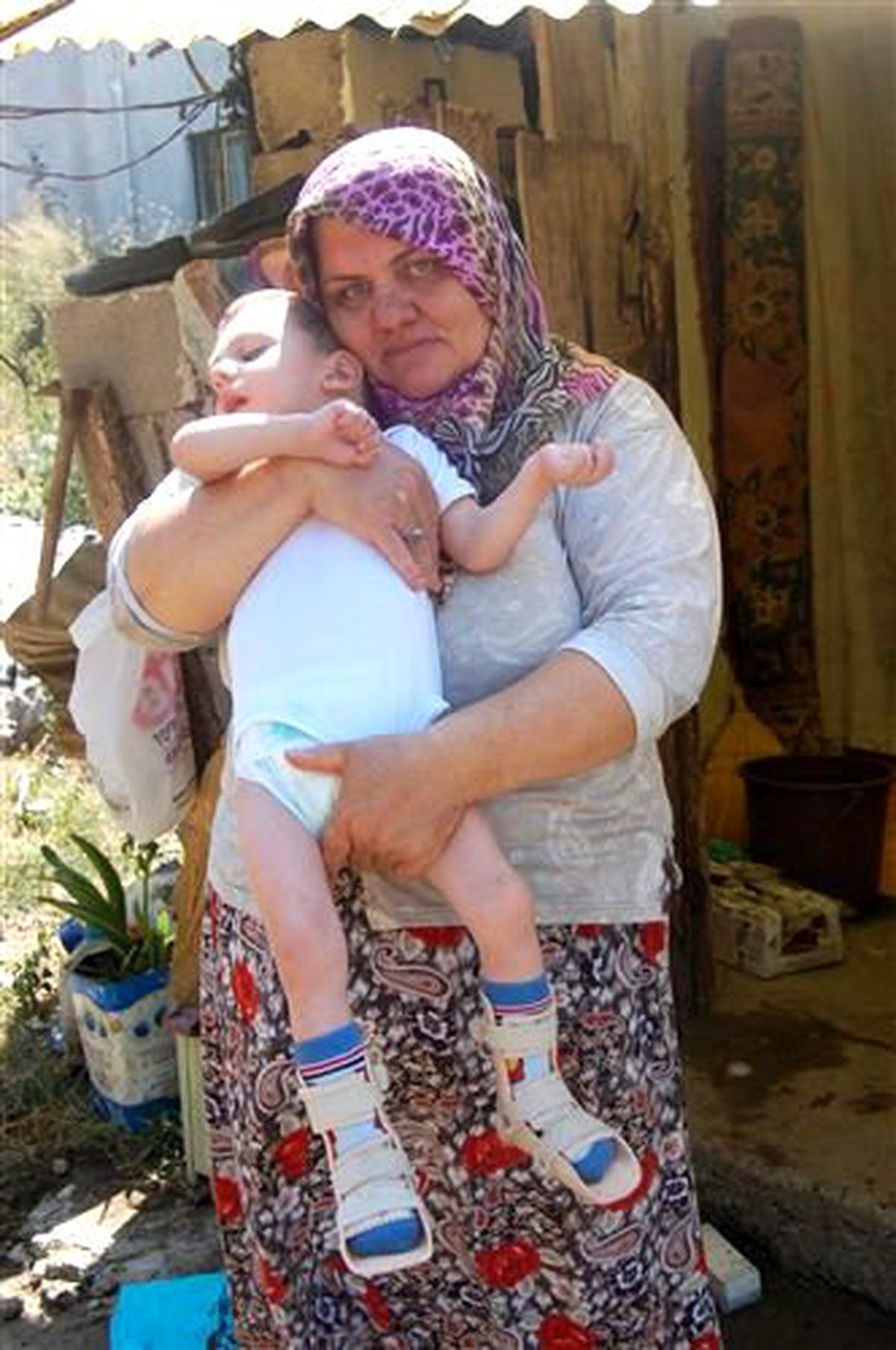 Yaşamaz Denilen Bebek 3 Yaşına Girdi, Sünnet Bile Oldu