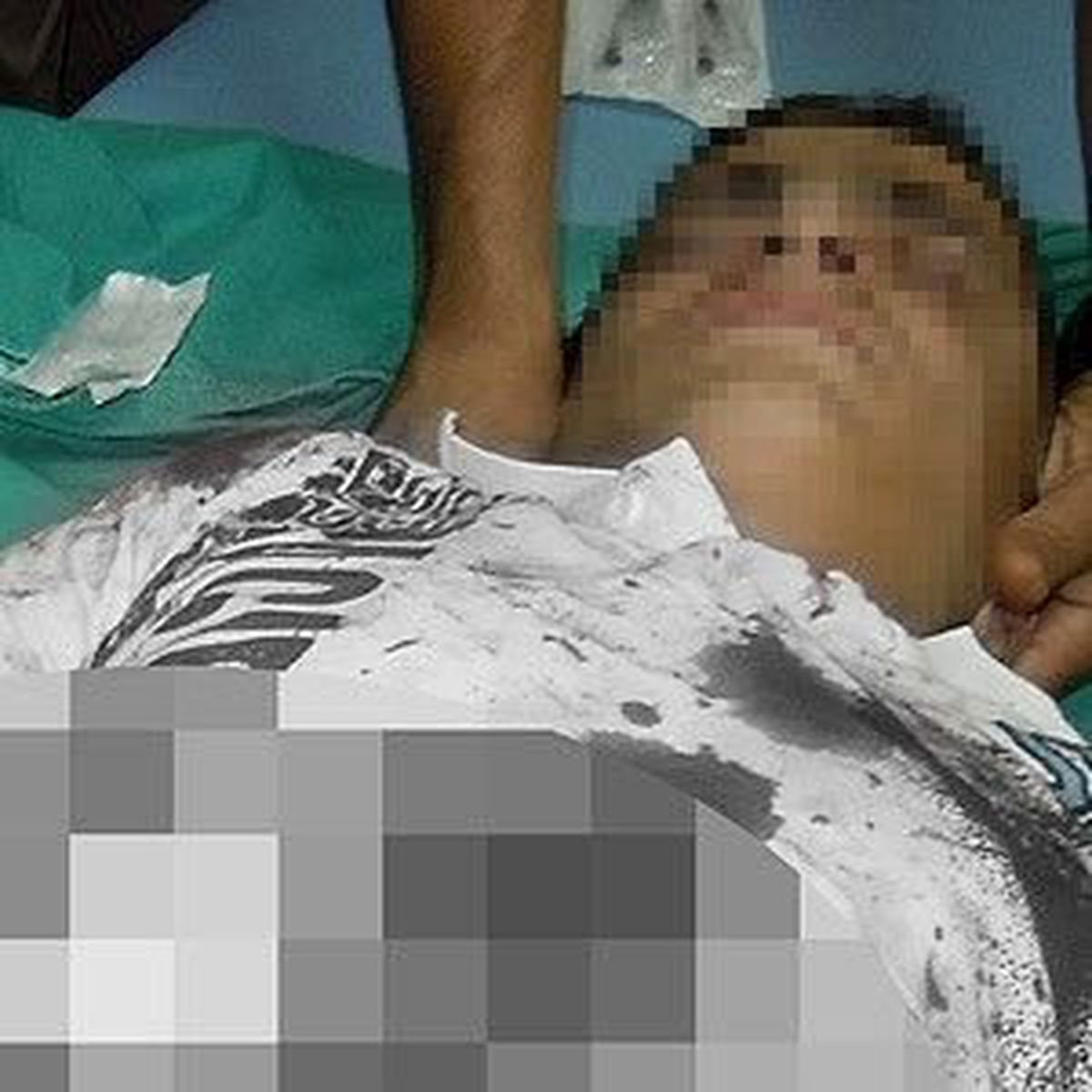Polise Atacağı Bomba Elinde Patladı