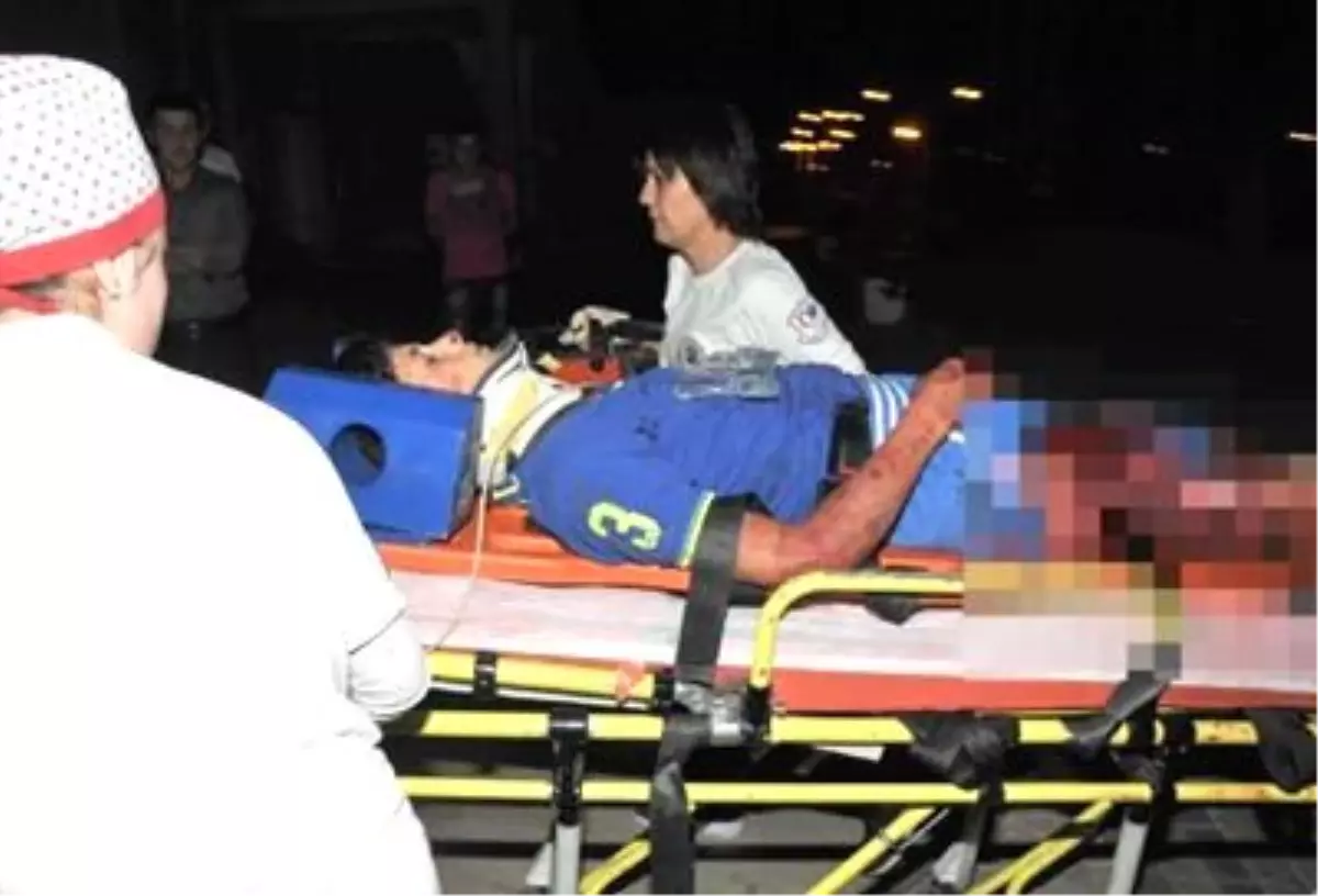 Bir Anlık İhmal Bacağından Etti