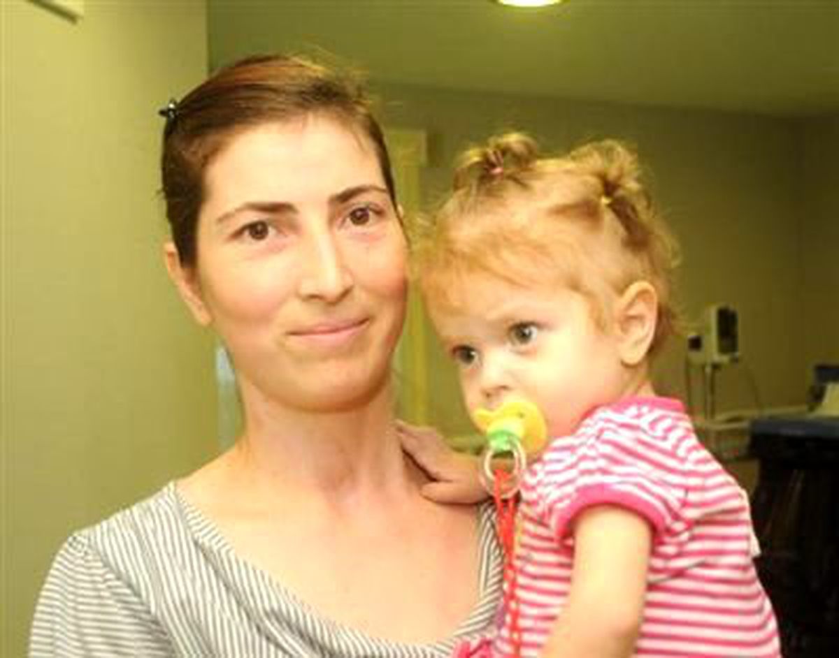 Ela Bebek, Annesinin Karaciğeriyle Hayat Buldu