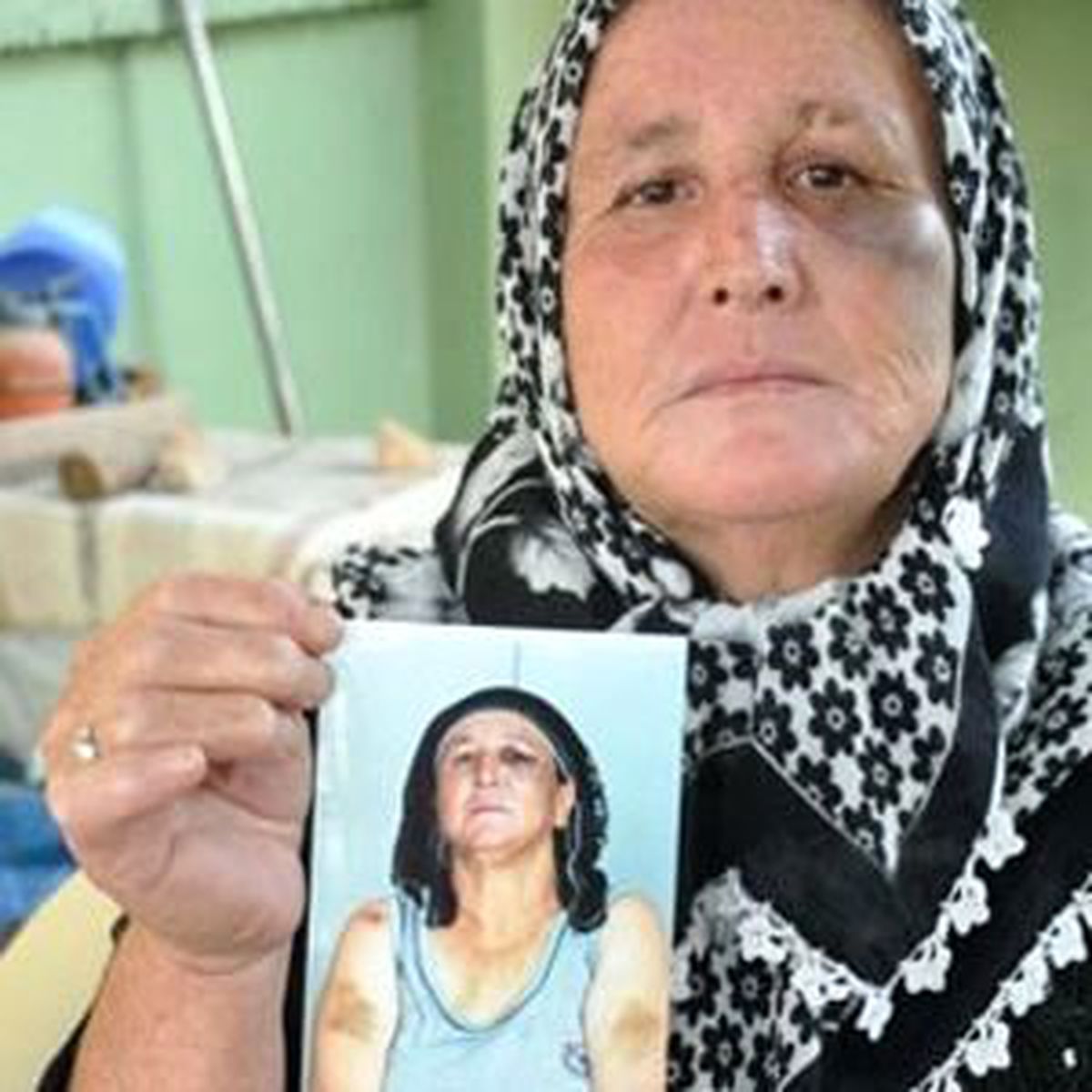 Gördüğü Şiddeti Fotoğrafla Belgeledi