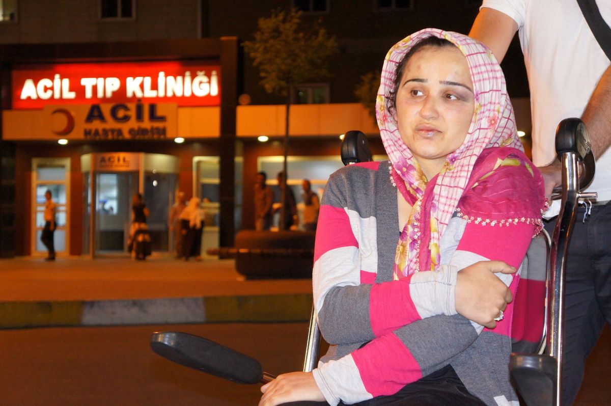 Eşini Döverek Hastanelik Etti