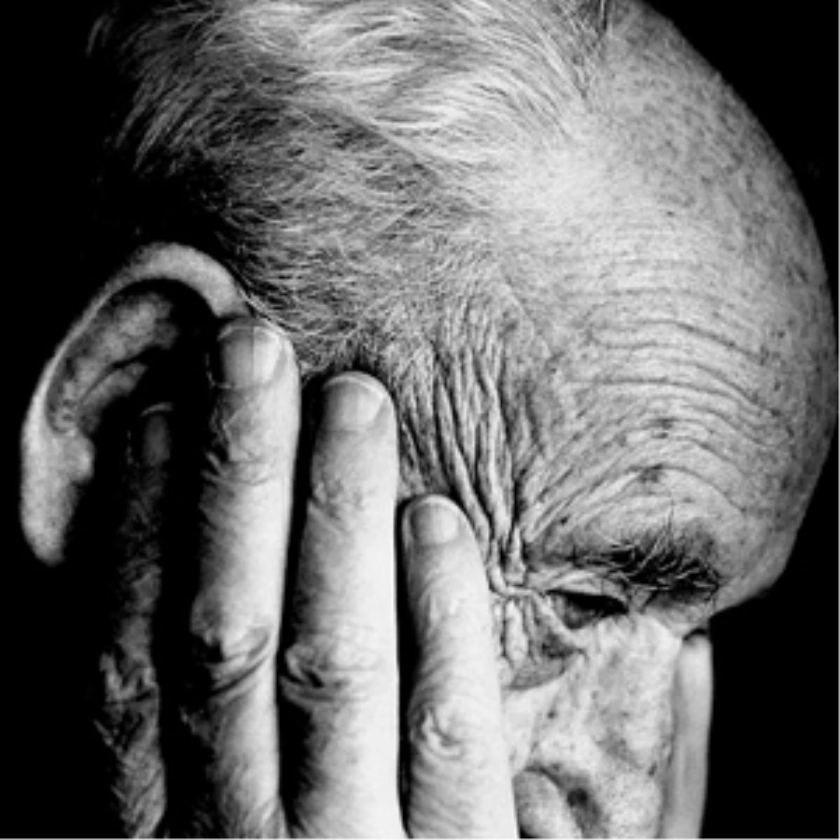 Alzheimerlılar Özel Ellerde Özel Merkezlerde Bakılacak