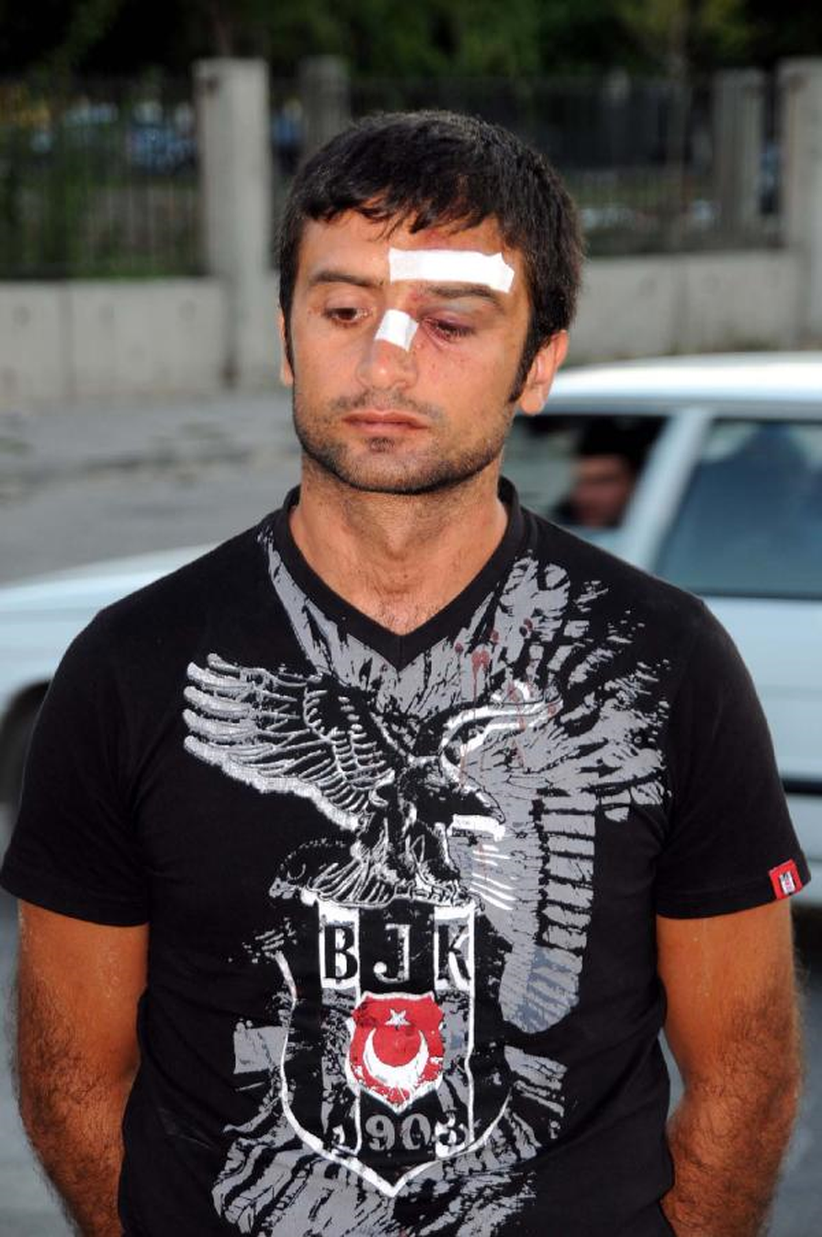 Çay Bahçesinde Öğretmene Dayak
