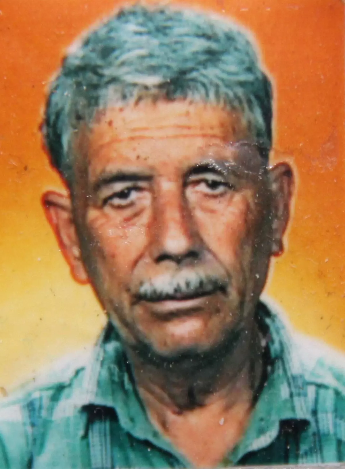 Sigara İçerken Yanarak Öldü