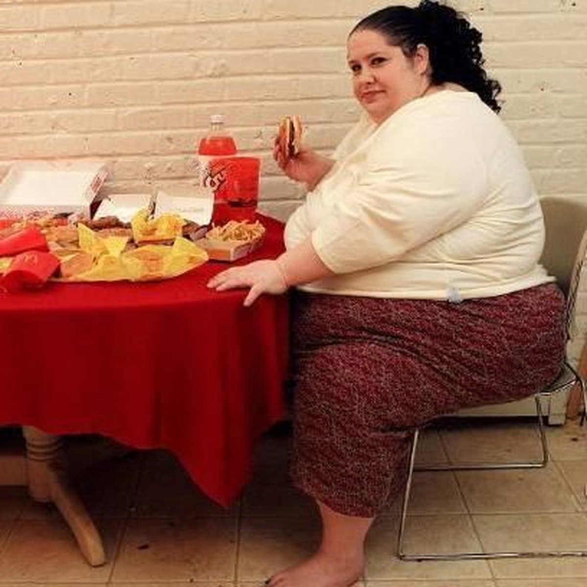Obezite, Safra Kesesi Taşına Neden Oluyor