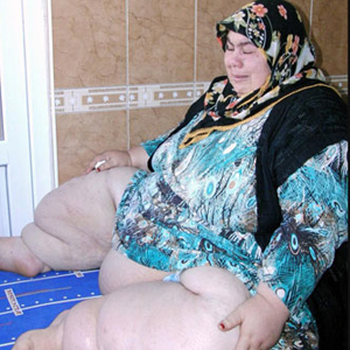 6 Yılda 95 Kilodan 250 Kiloya Çıktı