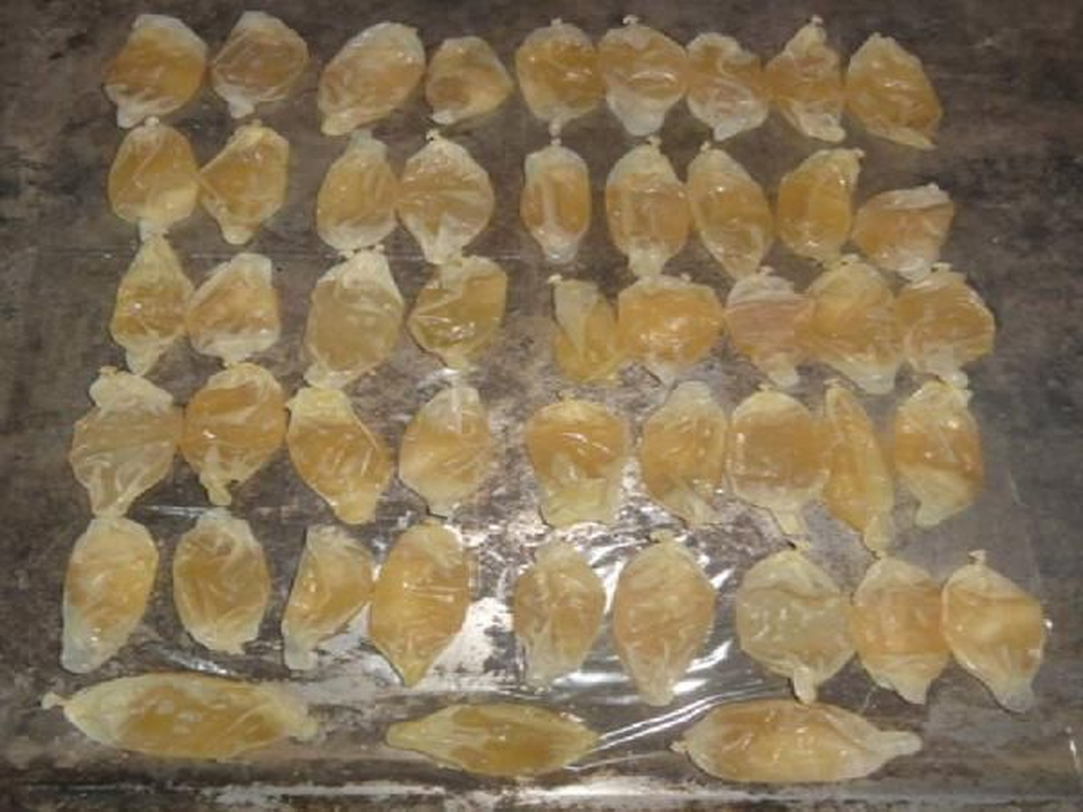 Midesinde 1 Kilo 125 Gram Kokainle Türkiye\'ye Geldi