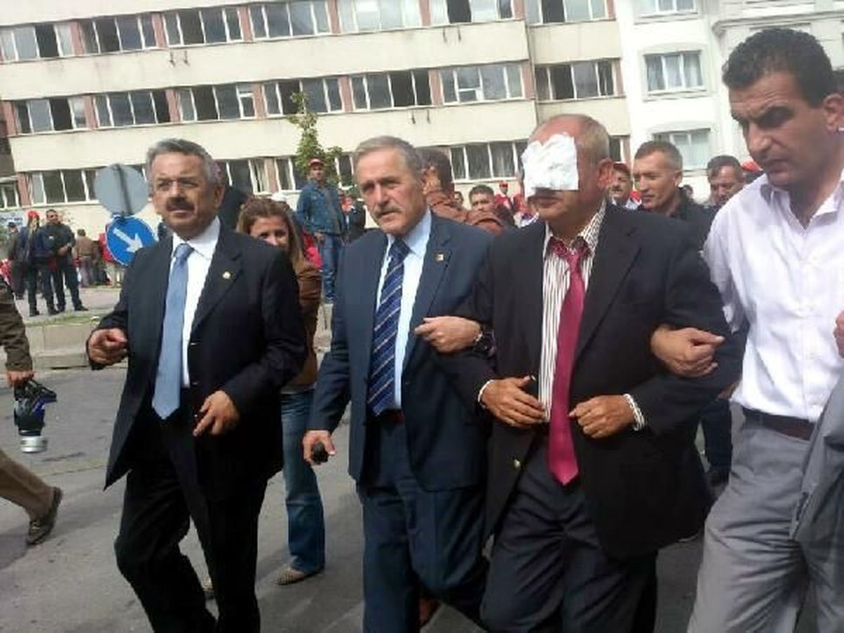 CHP\'li Vekili Hastaneye Böyle Götürdüler