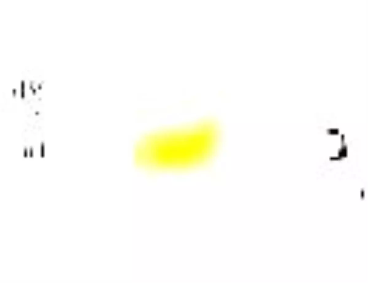 Infolang Dil Okulları\'nda "Nasıl Ödersen Öde, Hatta Hiç Ödeme" Fırsatını Kaçırmayın…