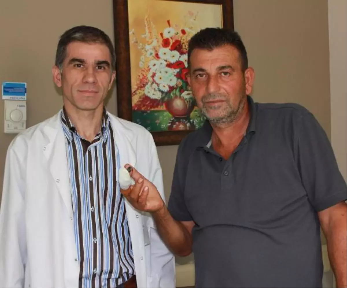 Kopan Parmak, Yerine Dikildi